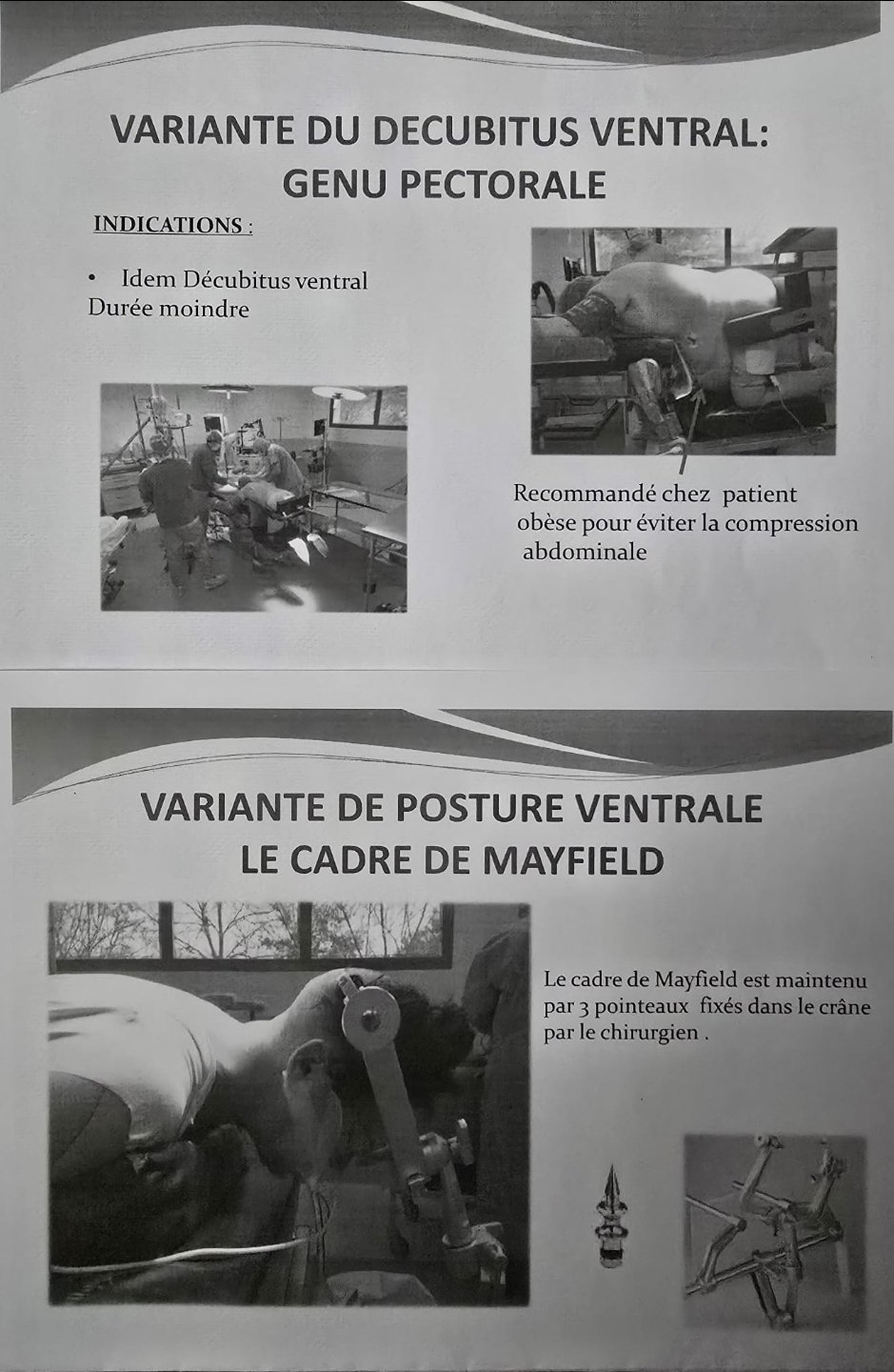 Variantes ventrales : genu pectorale et cadre de Mayfield