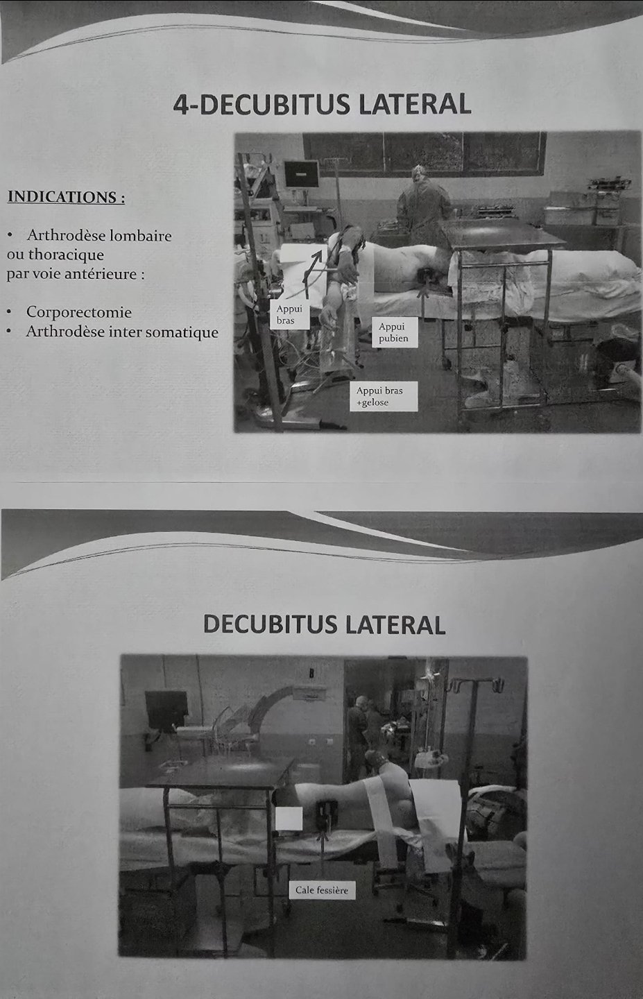 Décubitus latéral : exemples d'installation