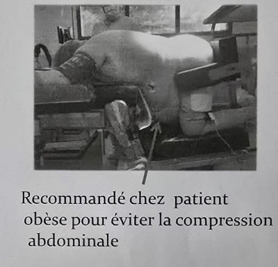 Diapo scannée