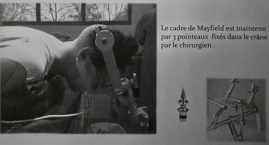 Diapo scannée